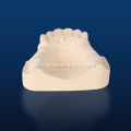 ແຂ້ວ zirconia porcelain peneer